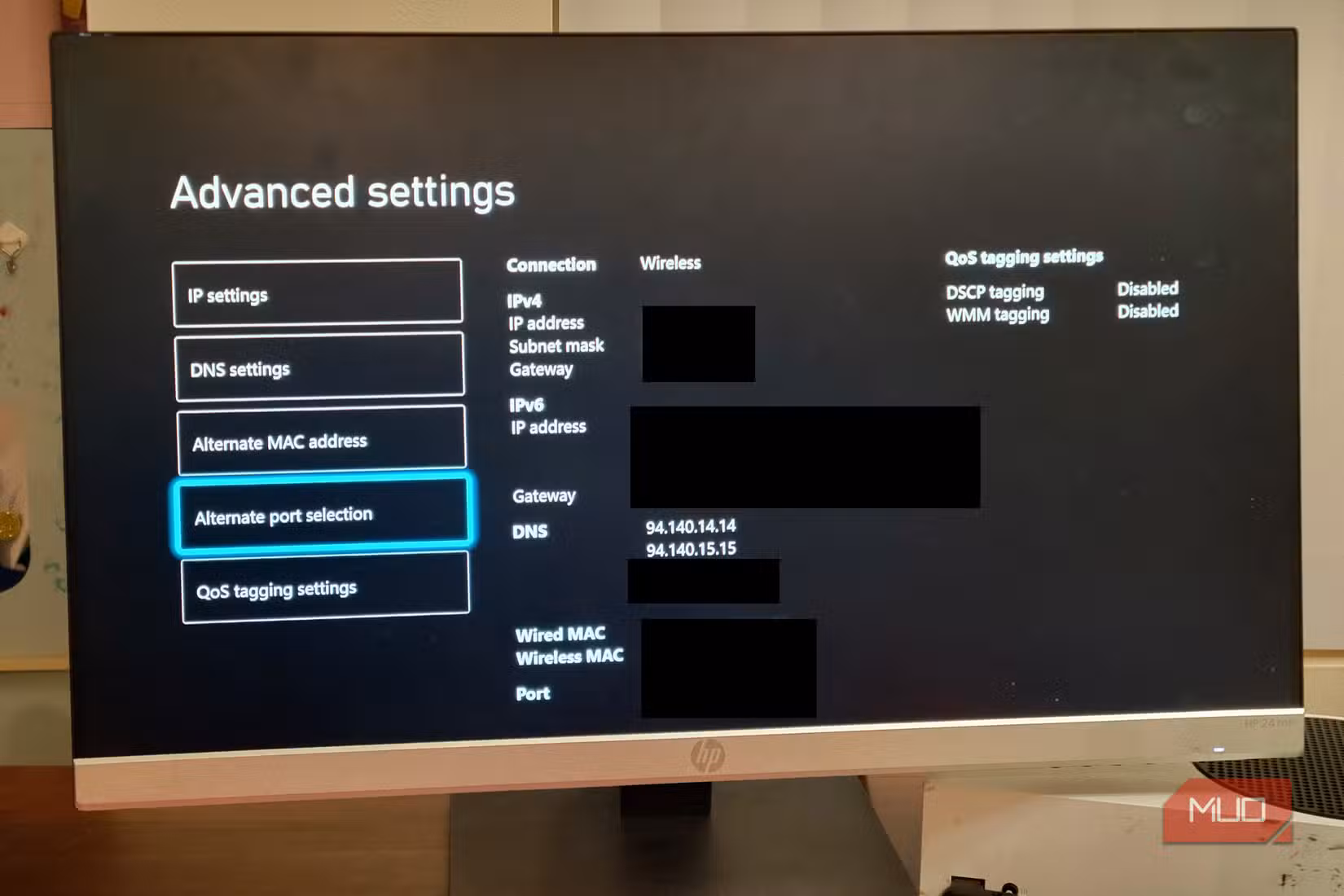 A microsoft Xbox showing the DNS IP
