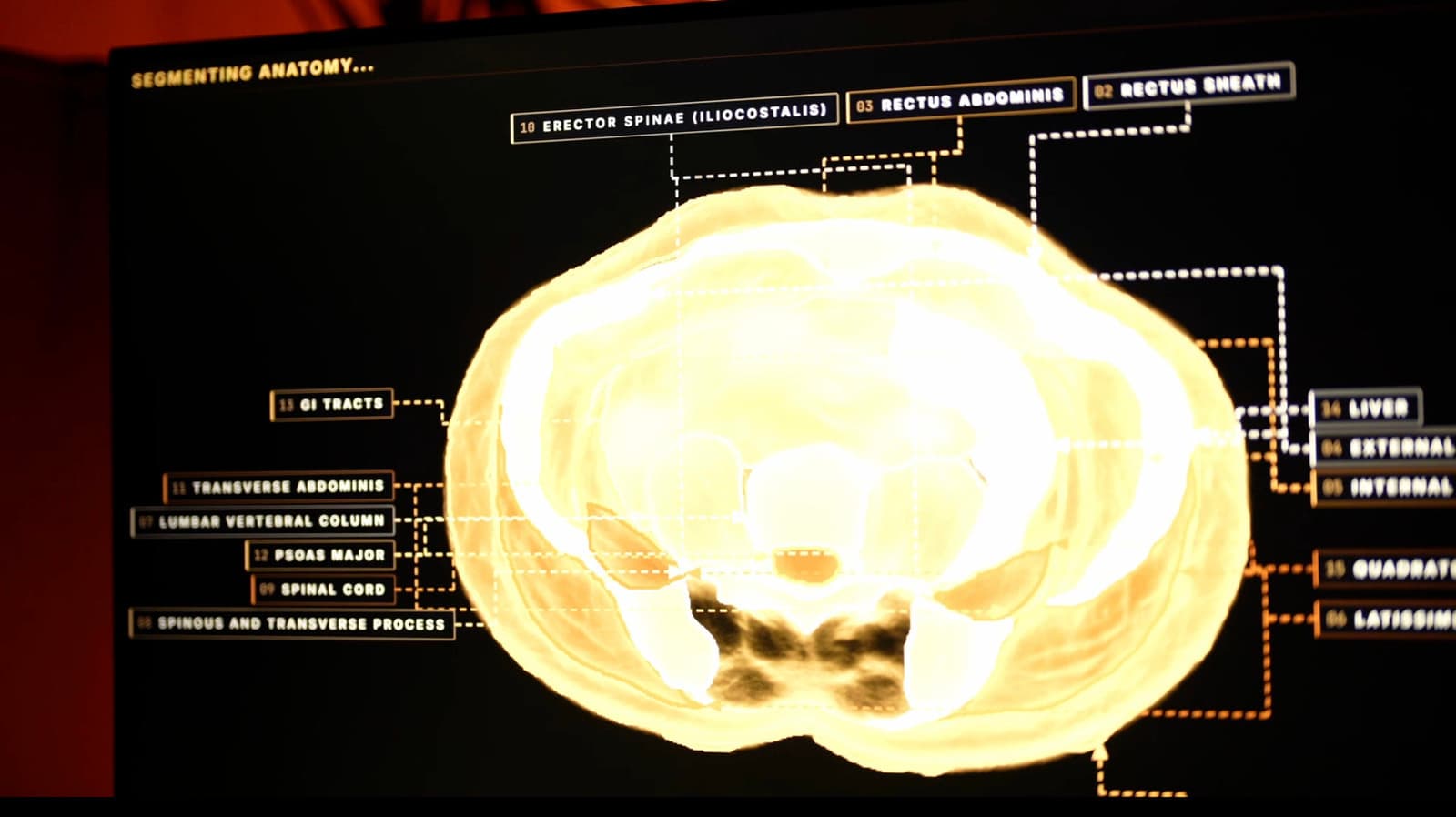 Midjourney is building a 60-second full-body ultrasonic scanner